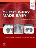 Chest X-Ray Made Easy 5e