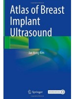 Atlas of Breast Implant Ultrasound