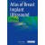 Atlas of Breast Implant Ultrasound