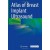 Atlas of Breast Implant Ultrasound