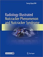 Radiology Illustrated: Nutcracker Phenomenon and Nutcracker Syndrome