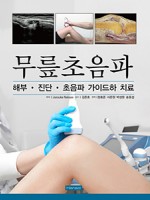 무릎초음파-해부 진단 초음파 가이드하 치료