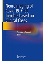 Neuroimaging of Covid-19. First Insights based on Clinical Cases