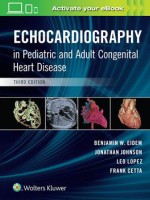 Echocardiography in Pediatric and Adult Congenital Heart Disease 3/e