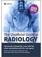 The Unofficial Guide to Radiology: 100 Practice Orthopaedic X Rays