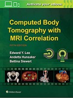 Computed Body Tomography with MRI Correlation 5e