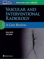 Vascular and Interventional Radiology: A Core Review