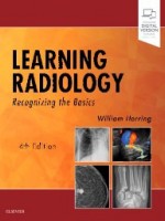 Learning Radiology 4e-Learning Radiology