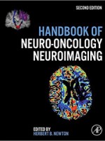 Handbook of Neuro-Oncology Neuroimaging,2/e