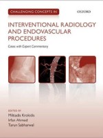 Challenging Concepts in INTERVENTIONAL RADIOLOGY