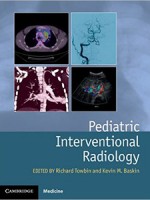 Pediatric Interventional Radiology