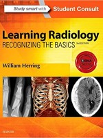 Learning Radiology: Recognizing the Basics,3/e