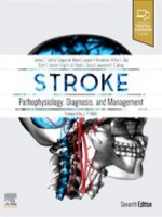 Stroke 7e-Pathophysiology, Diagnosis, and Management