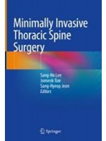 Minimally Invasive Thoracic Spine Surgery