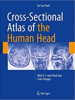 Cross-Sectional Atlas of the Human Head: With 0.1-mm pixel size color images