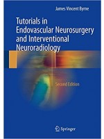 Tutorials in Endovascular Neurosurgery and Interventional Neuroradiology 2e