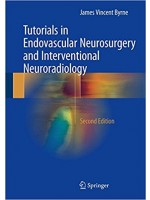 Tutorials in Endovascular Neurosurgery and Interventional Neuroradiology 2e