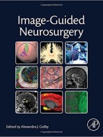 Image-Guided Neurosurgery