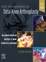 The Technique of Total Knee Arthroplasty 2e