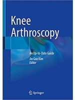 Knee Arthroscopy