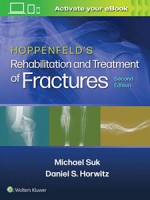 Hoppenfeld's Treatment and Rehabilitation of Fractures 2e