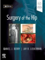 Surgery of the Hip 2e