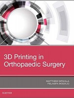 3D Printing in Orthopaedic Surgery