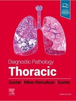 Diagnostic Pathology: Thoracic 3e