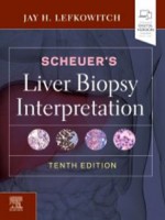 Scheuer's Liver Biopsy Interpretation 10e