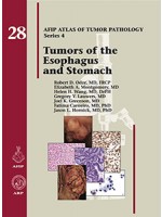 Tumors of the Esophagus and Stomach