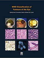 WHO Classification of Tumours of the Eye 4e