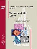 Tumors of the Liver(AFIP Atals of Tumor Pathology Series 4)