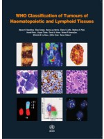 WHO Classification of Tumours of Haematopoietic and Lymphoid Tissues,4/e(revised edition)