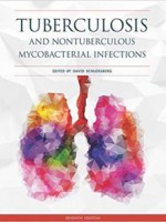 Tuberculosis and Nontuberculous Mycobacterial Infections,7/e