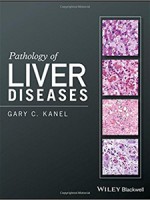 Pathology of Liver Diseases