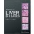 Pathology of Liver Diseases