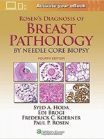 Rosen's Diagnosis of Breast Pathology by Needle Core Biopsy,4/e
