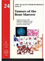 Tumors of the Bone Marrow