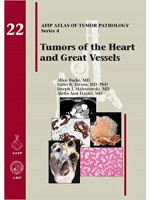Tumors of the Heart and Great Vessels