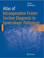 Atlas of Intraoperative Frozen Section Diagnosis in Gynecologic Pathology