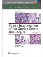 Biopsy Interpretation of the Uterine Cervix and Corpus 2e(Biopsy Interpretation Series)