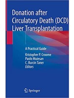 Donation after Circulatory Death (DCD) Liver Transplantation: A Practical Guide