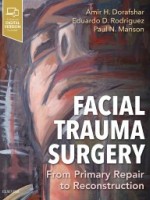 Facial Trauma Surgery: From Primary Repair to Reconstruction