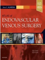 Atlas of Endovascular Venous Surgery 2e