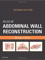 Atlas of Abdominal Wall Reconstruction, 2/e