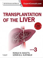 Transplantation of the Liver,3/e(Expert Consult - Online and Print)