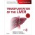 Transplantation of the Liver,3/e(Expert Consult - Online and Print)