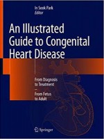 An Illustrated Guide to Congenital Heart Disease