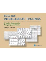 ECG and Intracardiac Tracings: A Toolkit Approach for Analyzing Arrhythmias