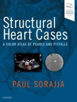 Structural Heart Cases:A Color Atlas of Pearls and Pitfalls